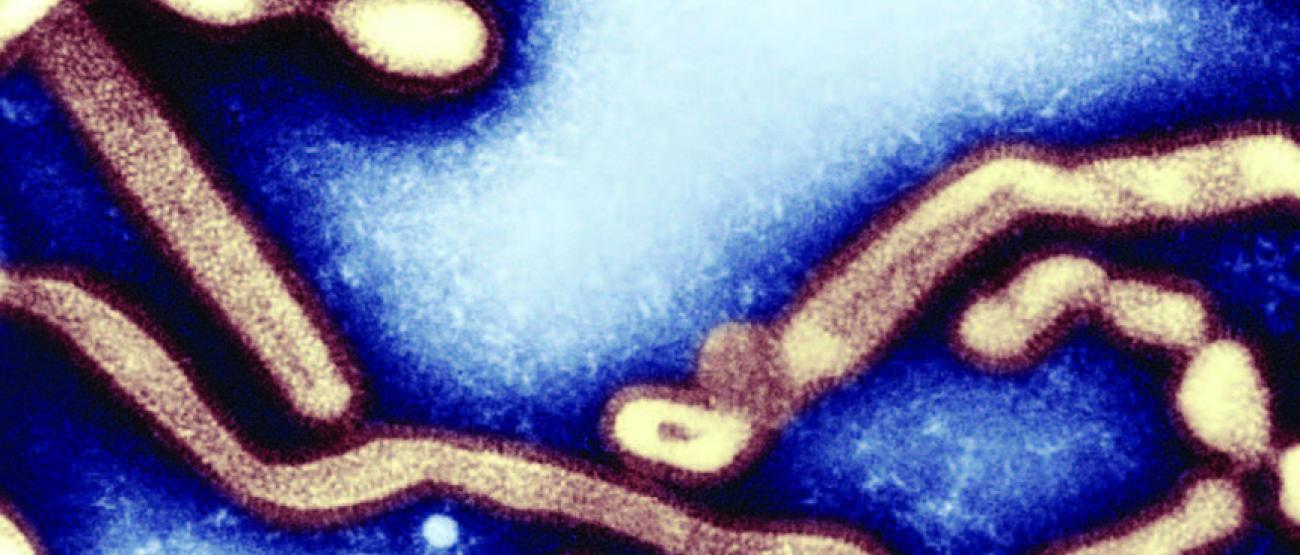 Microscopic view of Influenza virus
